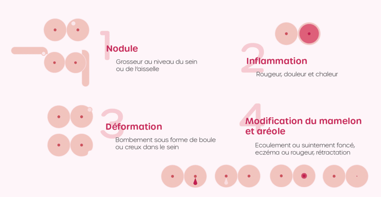 Quand faut il consulter pour un problèmes de seins? : symptômes,  traitement, définition 